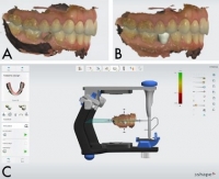 THIẾT KẾ MÁNG HƯỚNG DẪN PHẪU THUẬT VỚI PHẦN MỀM IMPLANT STUDIO 